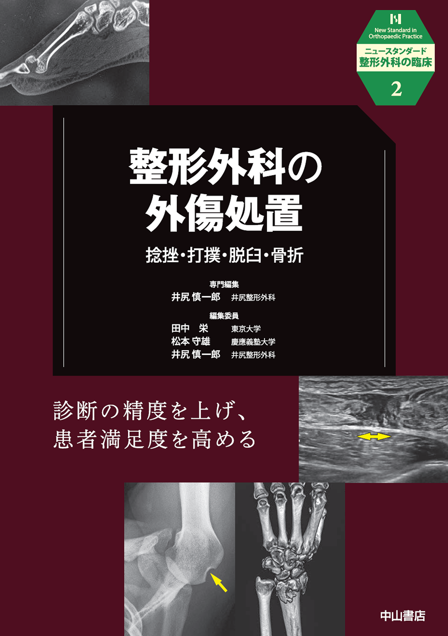 整形外科の病外傷処置－捻挫、打撲、脱臼、骨折－